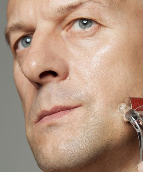 Handsome Caucasian man massaging face using rejuvenating microneedling beauty device macro portrait