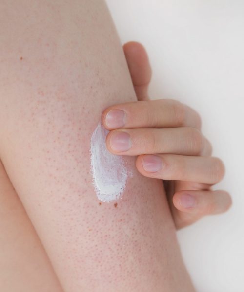 Nahaufnahme eines jungen Mannes mit Keratosis Pilaris