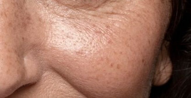 Premium-Photo-Close-up-on-face-pores-texture